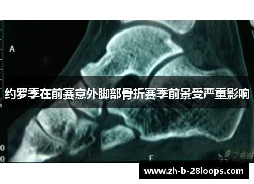 约罗季在前赛意外脚部骨折赛季前景受严重影响